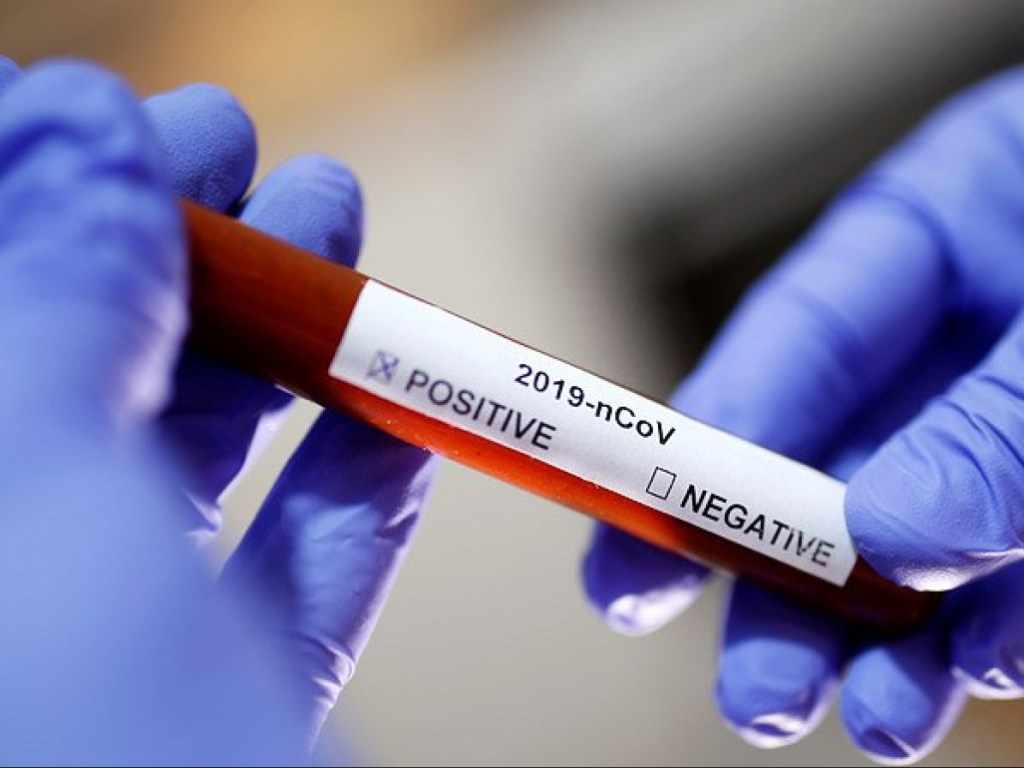 На Житомирщине подтверждено 525 случаев заражения коронавирусом