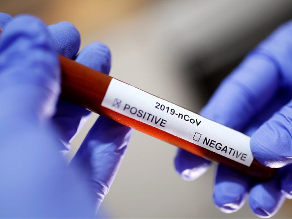 Более 60 стран призвали расследовать происхождение коронавируса