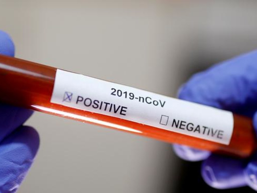 Эксперт: нужно тестировать на коронавирус как можно больше населения