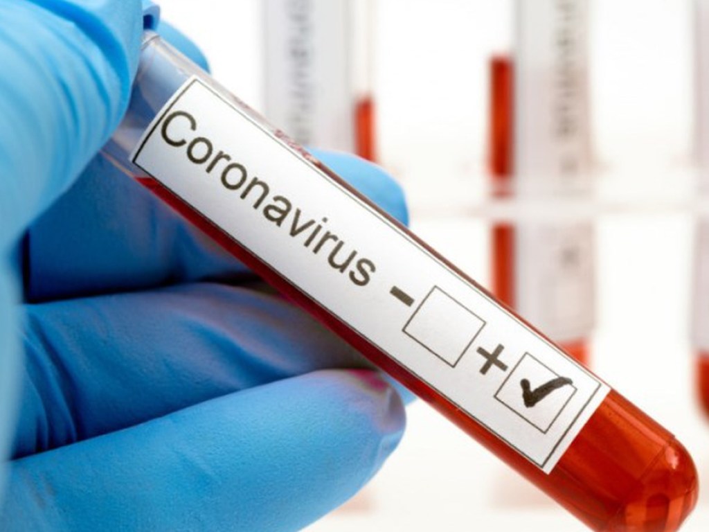 С начала пандемии коронавируса в Украине умерли 34 медика
