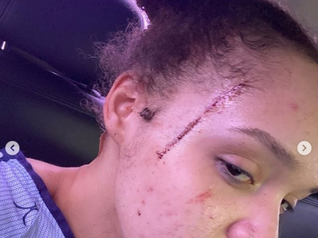 В США расистка напала с ножом на племянницу Майкла Джексона (ФОТО)