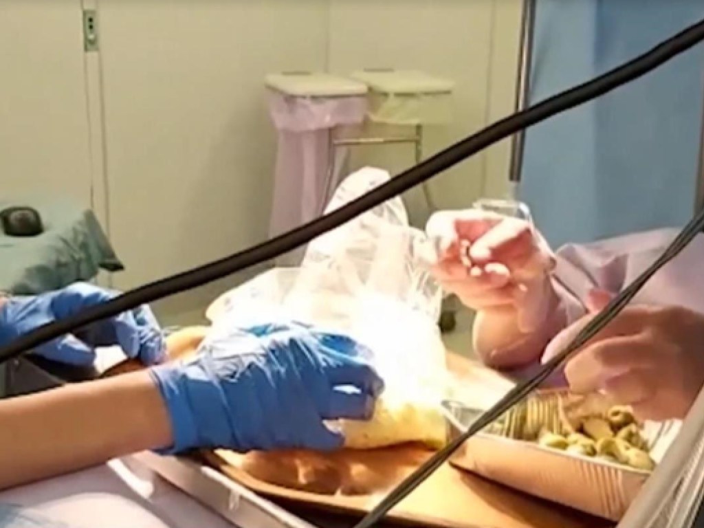 60-летней женщине оперировали мозг, а она фаршировала оливки (ВИДЕО)