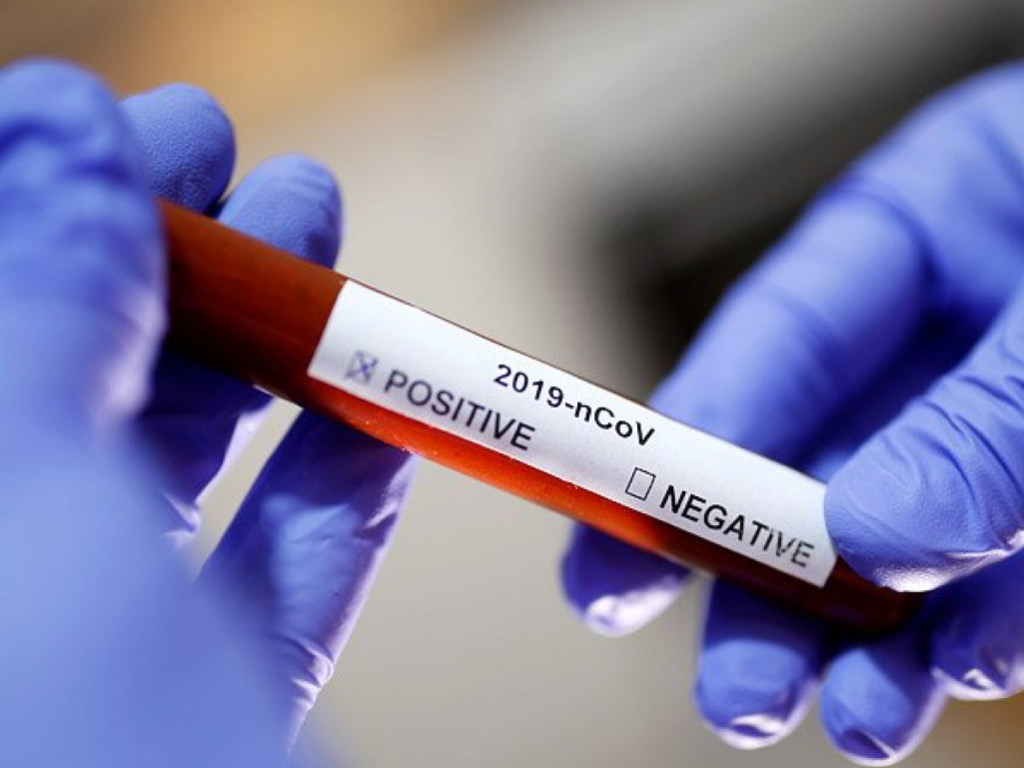 На Закарпатье за сутки выявили 49 коронавирусных пациентов