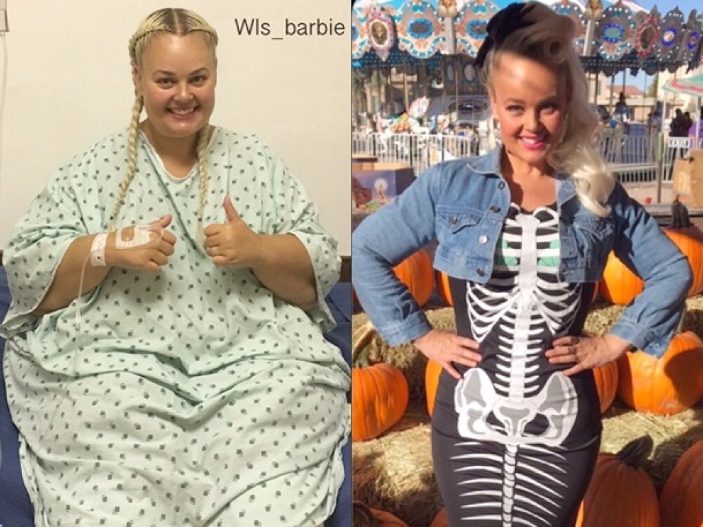 35-летняя австралийка, с 7 лет страдавшая от ожирения, похудела на 82 килограмма (ФОТО)
