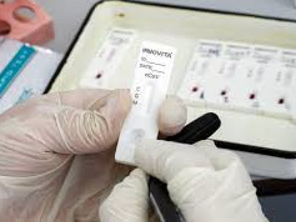 В Японии разработали простой и быстрый тест на коронавирус