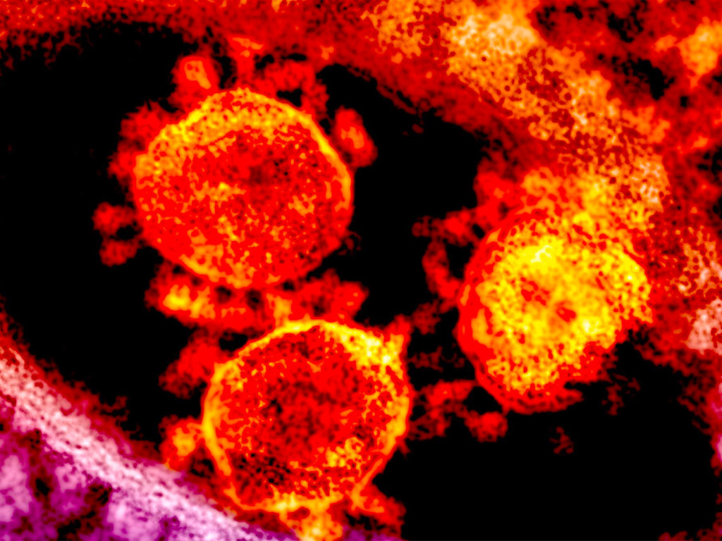 Врач-инфекционист предупредил: в Украине ситуация с коронавирусом скоро станет неконтролируемой