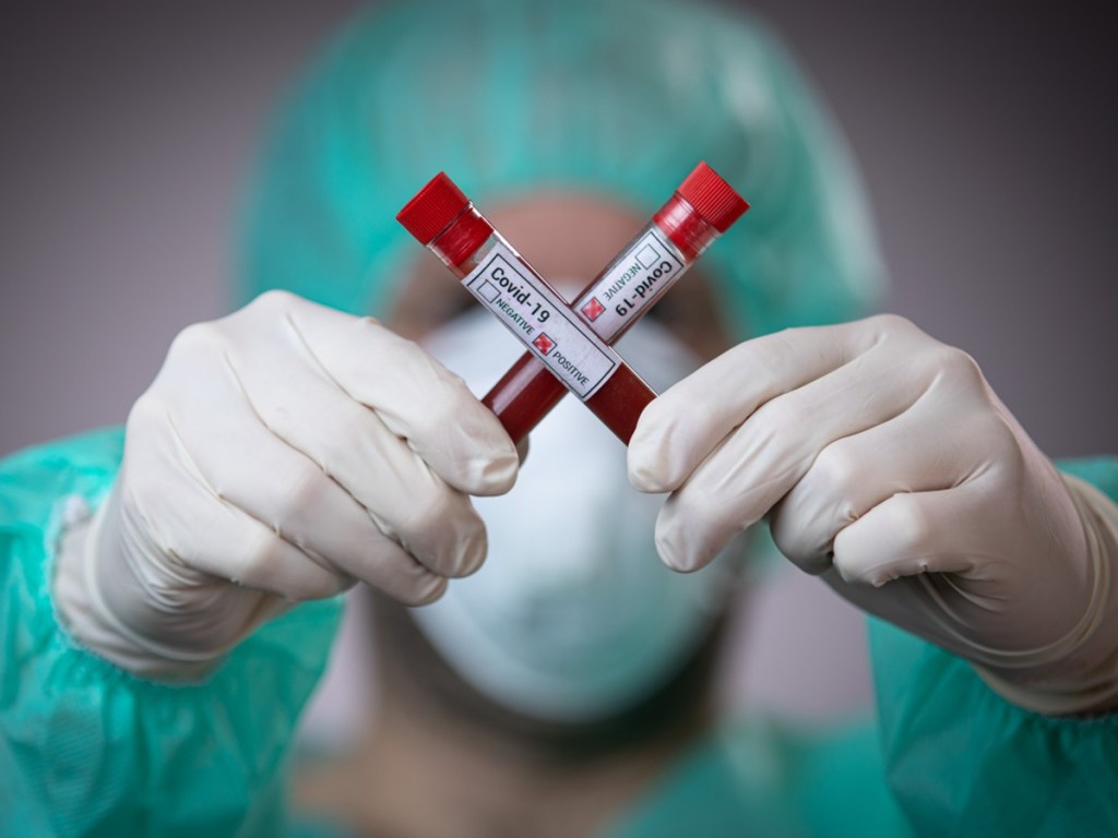 Эксперты просят отказаться от дезодорантов для борьбы с коронавирусом