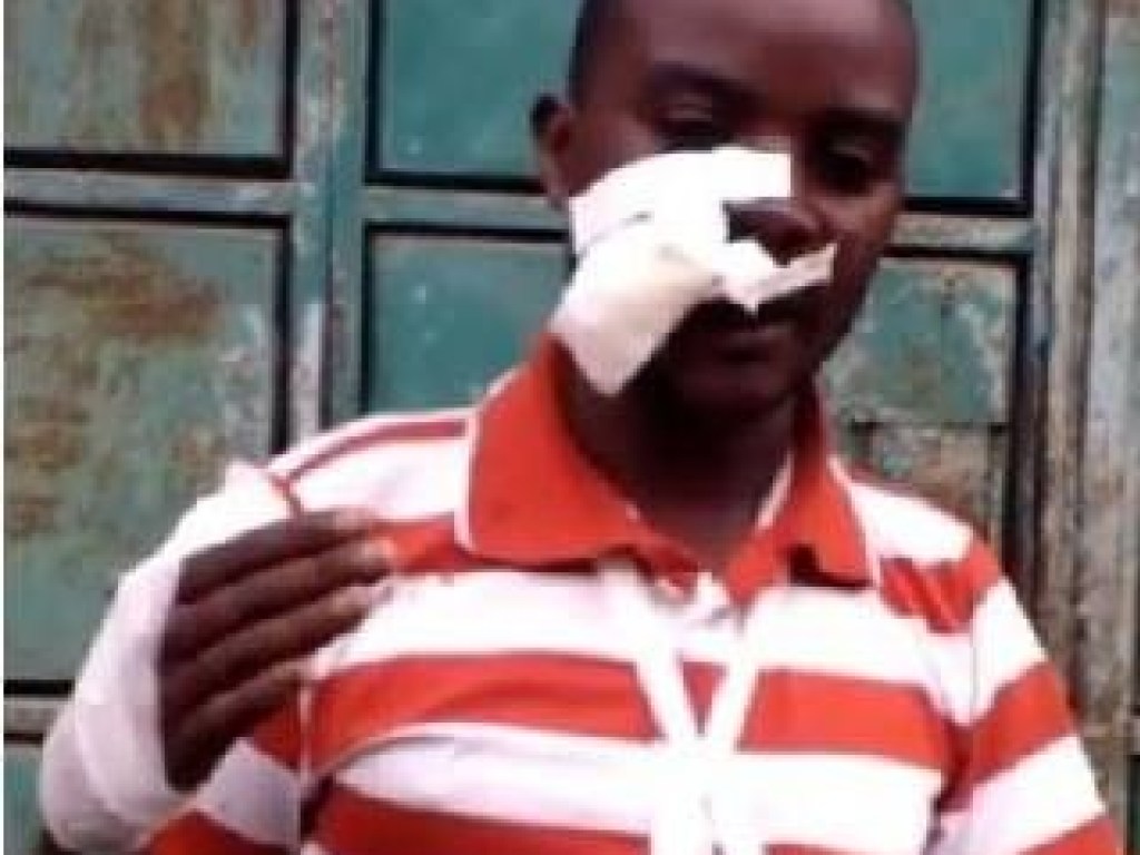 В Кении павиан сбросил местного жителя с крыши (ФОТО, ВИДЕО)