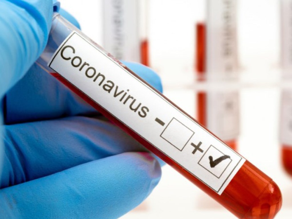 Минздрав: наибольшее количество заболеваний коронавирусом зафиксировано в Киеве и 2 областях