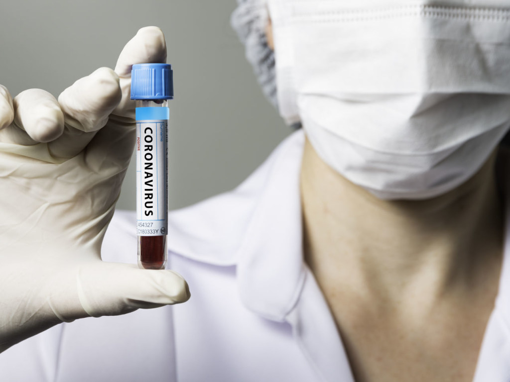 В Украине за сутки зафиксировали свыше 700 новых случаев заражения коронавирусом