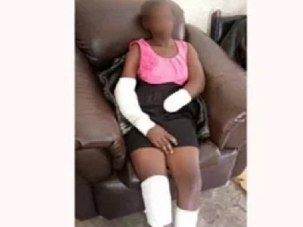 Мужчина отрубил руку 16-летней девушке за отказ выйти за него замуж (ФОТО)