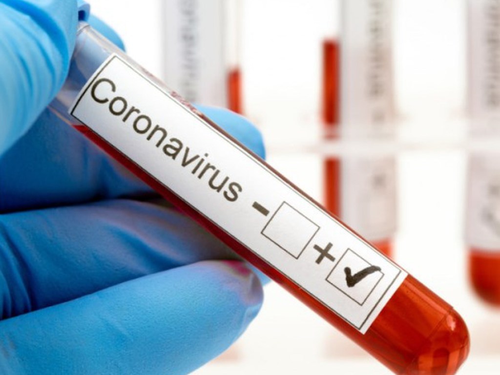 За сутки в Украине зафиксировано еще 919 человек с коронавирусом