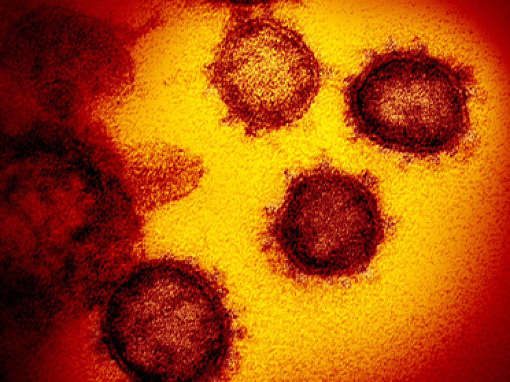 Медики признали бессимптомное носительство коронавируса опасным