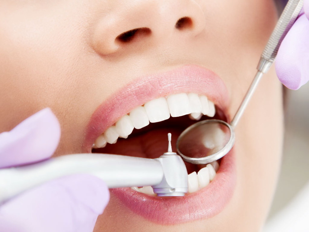 «Мифы о кариесе»: частая чистка зубов не панацея в борьбе с заболеванием &#8212; стоматолог