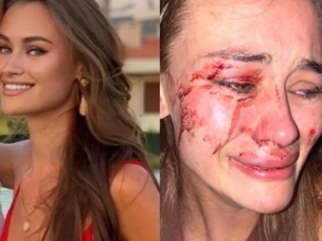 Избиение украинской модели на турецком пляже: появилось видео инцидента