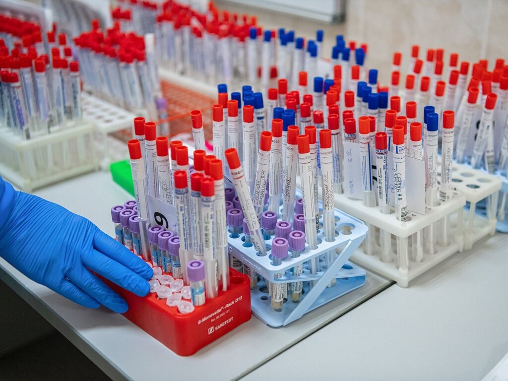 На Львовщине переходят к второй волне подготовки больниц для зараженных коронавирусом
