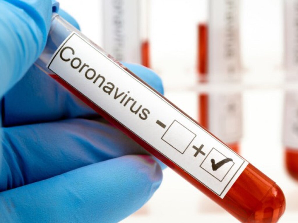В Киеве коронавирус за сутки обнаружили у почти 200 человек &#8212; Кличко