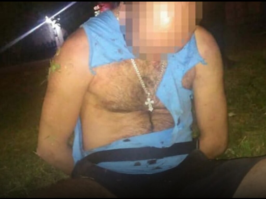 В Ивано-Франковске мужчине на улице неизвестный вонзил нож в шею (ФОТО, ВИДЕО)