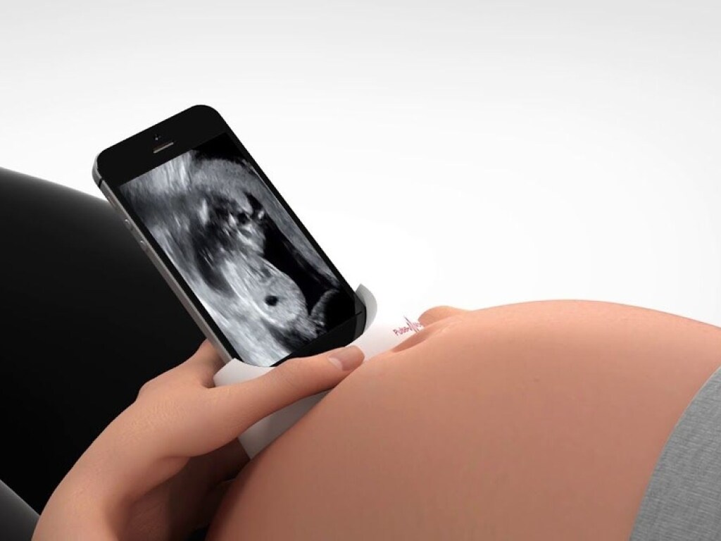 В Израиле беременные смогут на дому провести УЗИ с помощью смартфона (ФОТО) 