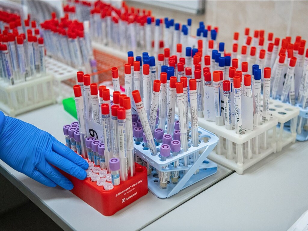 Коронавирус в Украине: за сутки зафиксировали более 1600 новых случаев