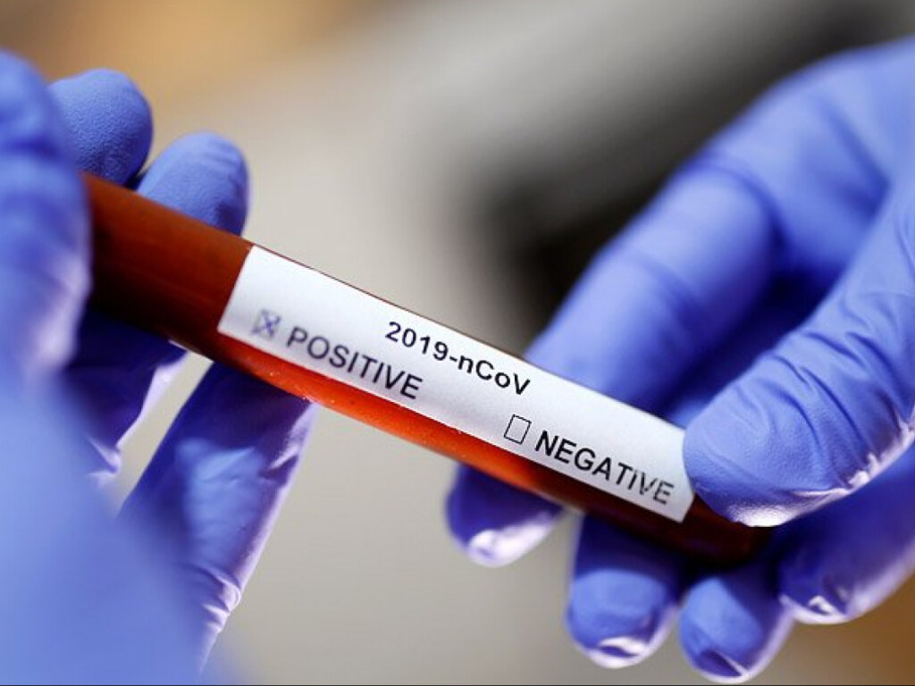 В Киеве за сутки зафиксировали 146 случаев коронавируса