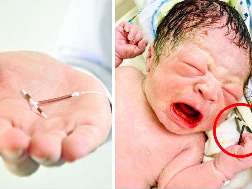 Во Вьетнаме родился малыш с контрацептивом в руке (ФОТО)