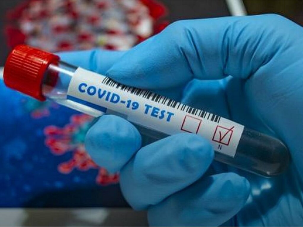 В Киеве за сутки зафиксировали 176 новых случая коронавируса – Кличко (КАРТА)