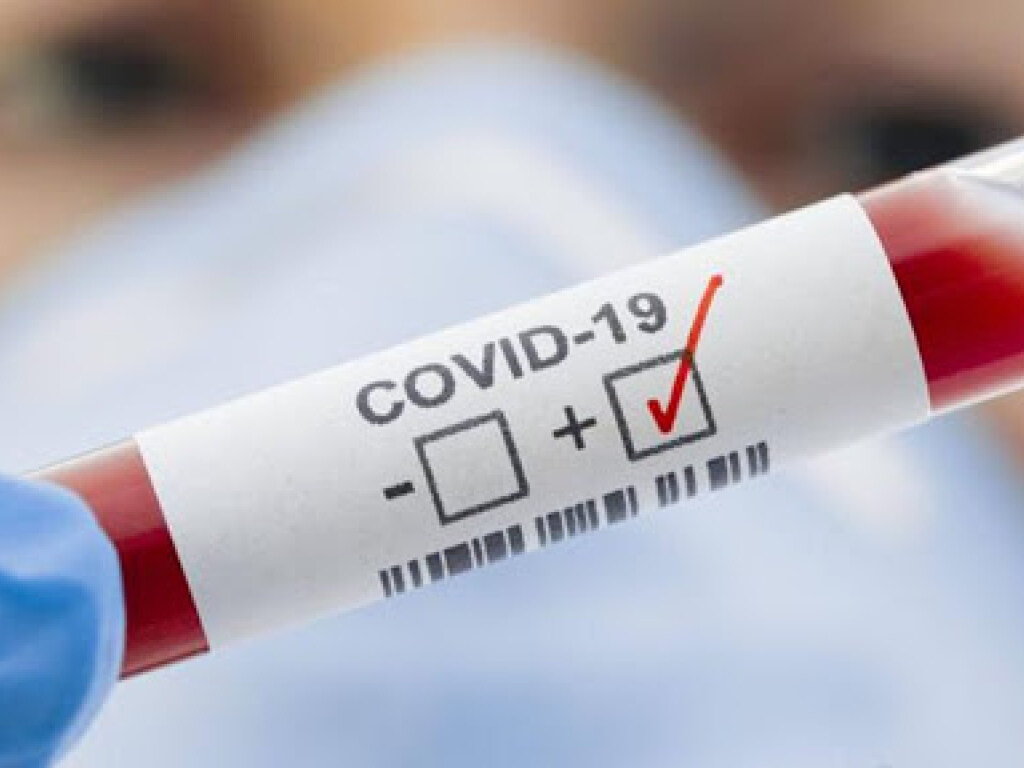 В Днепре в десять раз возросло количество случаев заболеваемости на COVID-19 &#8212; могут усилить карантин