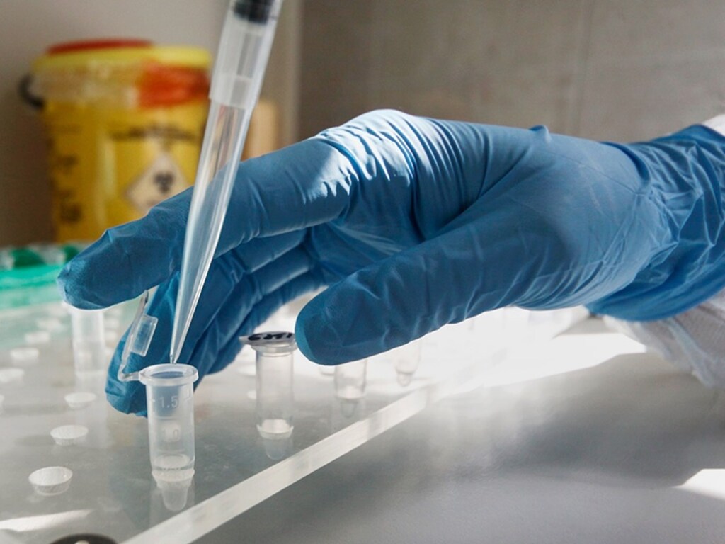 В Киевском городском лабораторном центре прекратят тестирование частных лиц на коронавирус