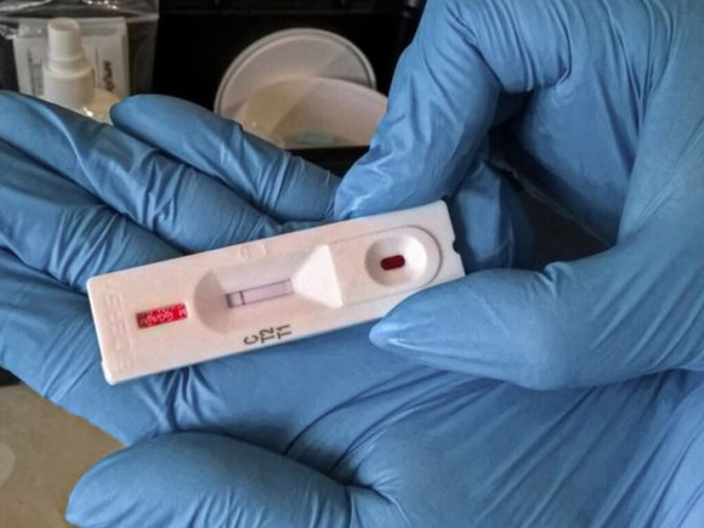В Одесской области чиновники заявили о нехватке тест-систем для диагностики коронавируса