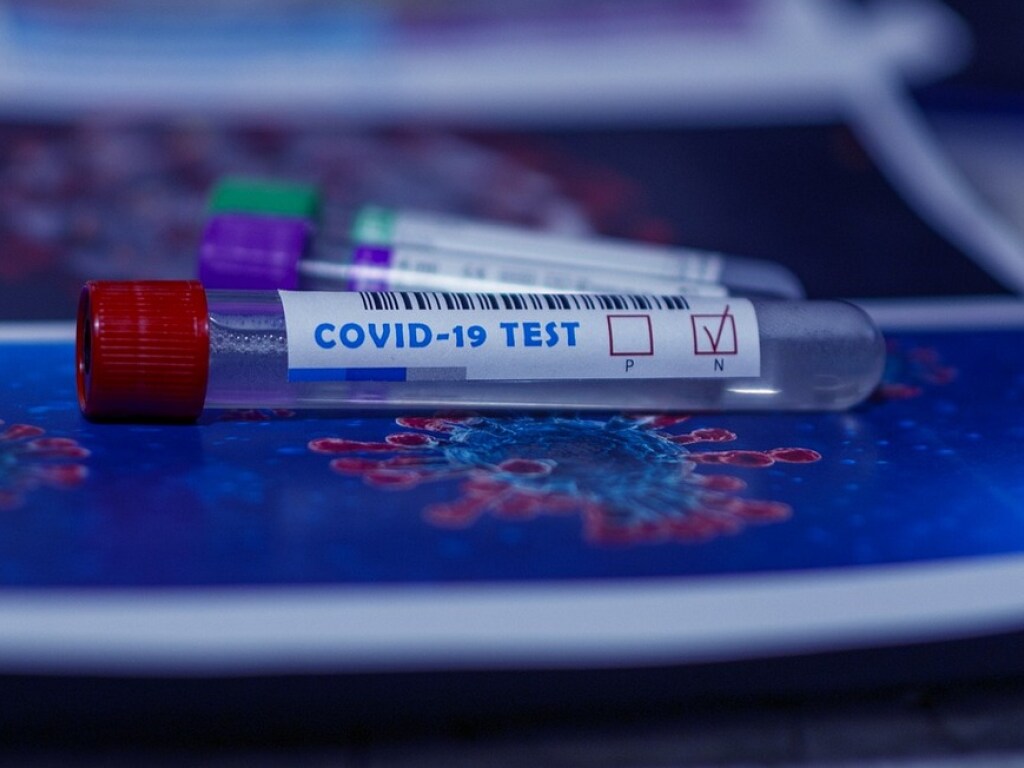 В Украине за сутки зафиксировали почти 2500 новых случаев коронавируса