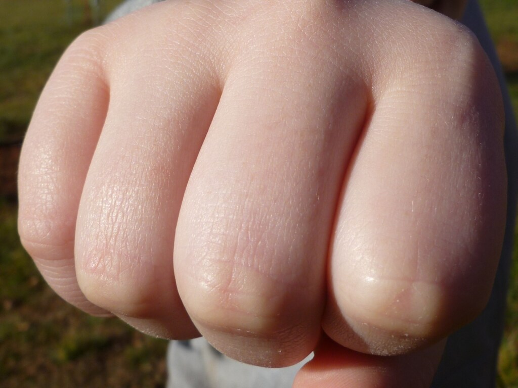 Конфликт с пострадавшими под Днепром: фермеры и лесорубы не поделили деревья (ВИДЕО)