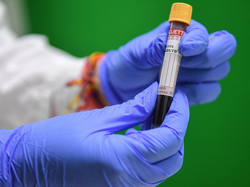 В Ровенской области зафиксирован первый повторный случай заражения коронавирусом