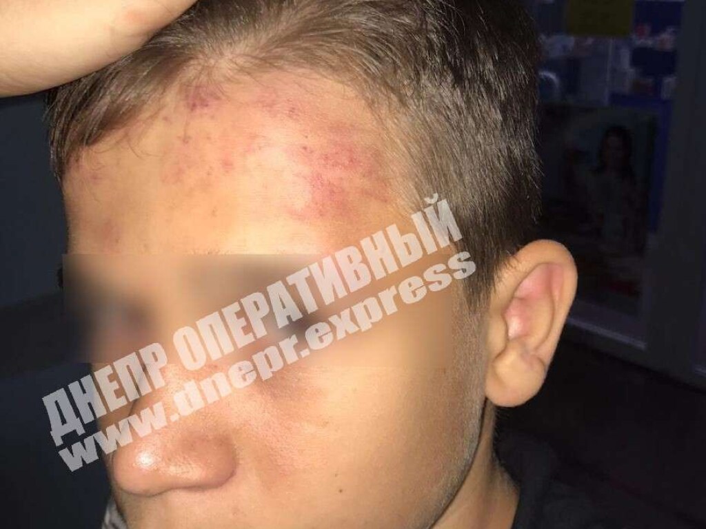 В Никополе ромы у школы избили 12-летнего мальчика (ФОТО)