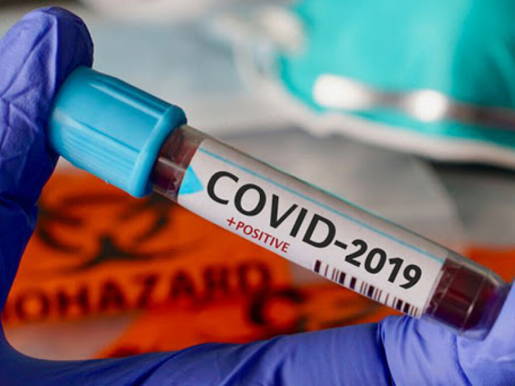 За сутки в Украине коронавирусом заболели 3771 человек