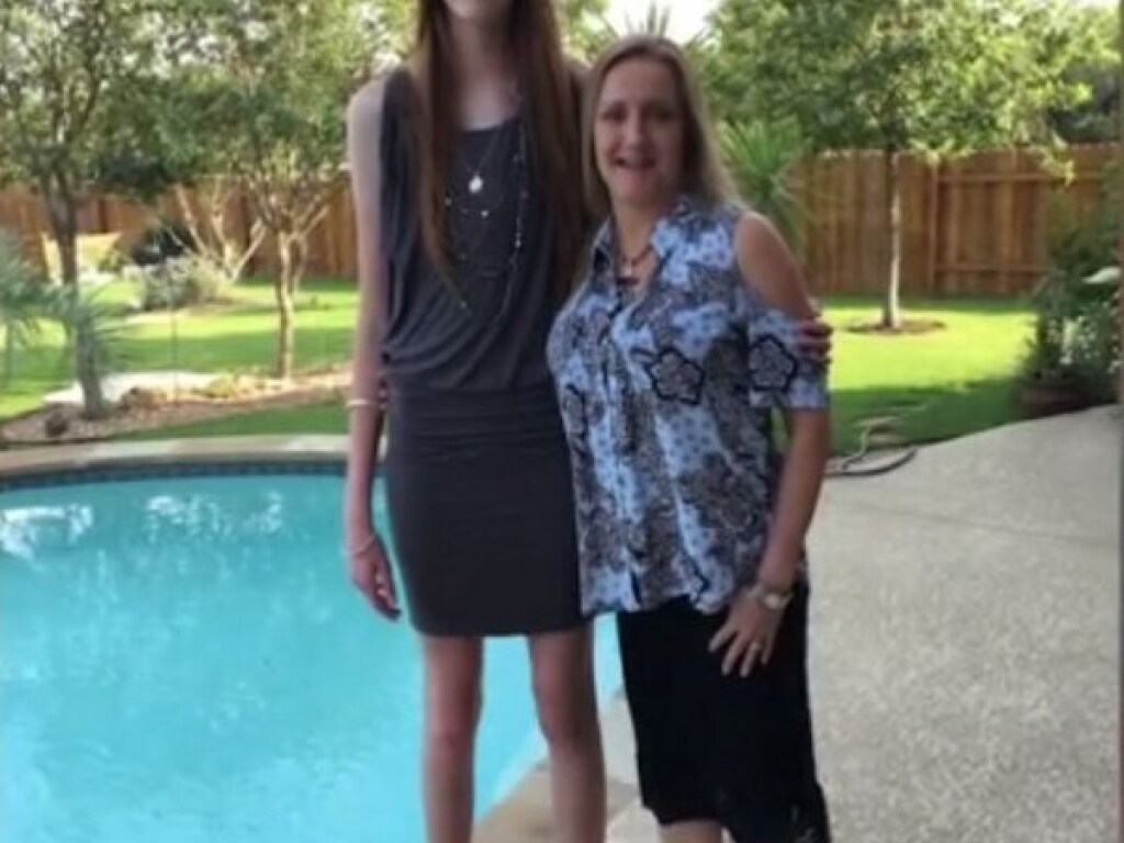 17-летняя девушка с самыми длинными в мире ногами вошла в Книгу рекордов Гиннесса (ФОТО)