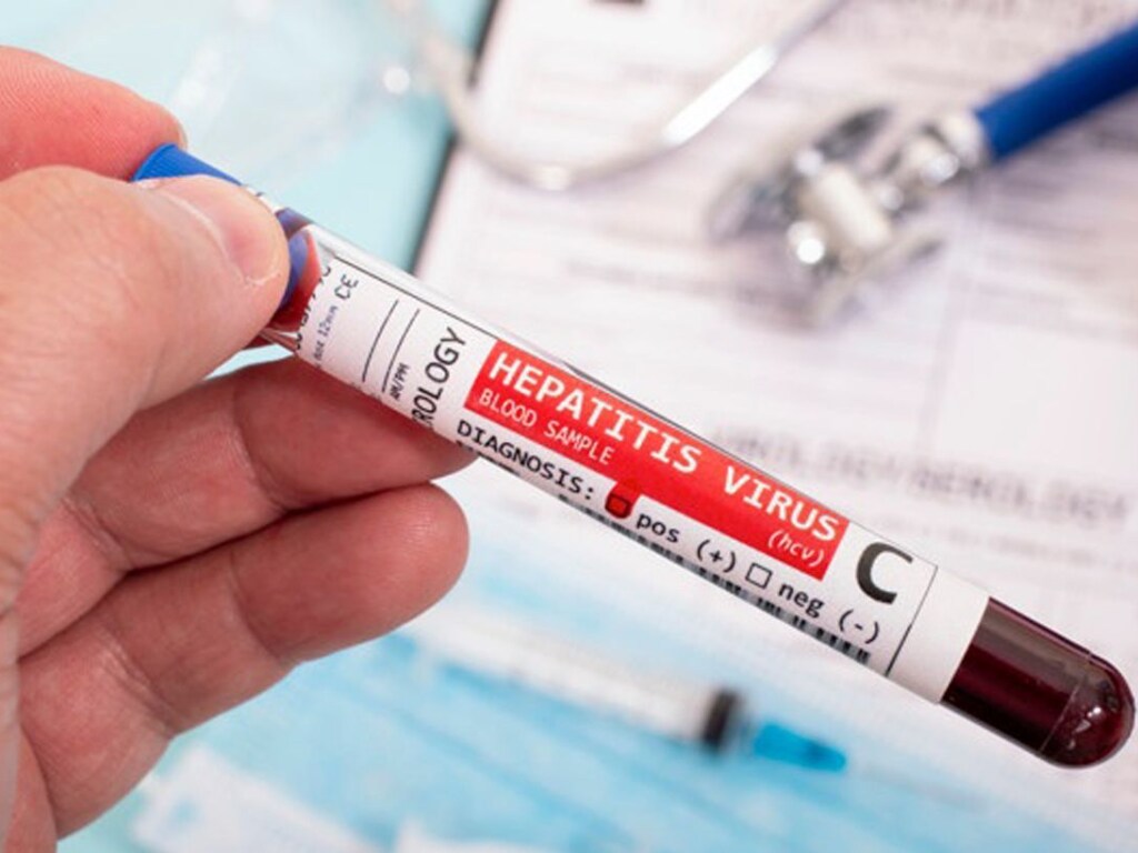 Медики рассказали, как распознать гепатит С и кто чаще всего подвержен этому заболеванию
