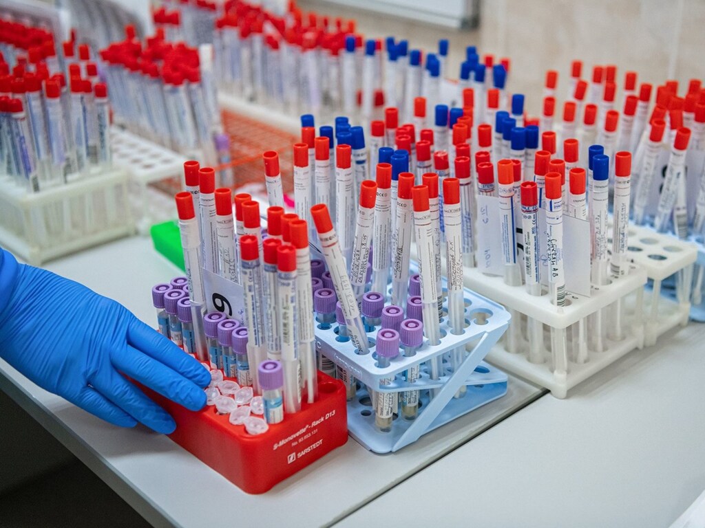 В ЦОЗ дали комментарий о повторных случаях заболевания COVID-19