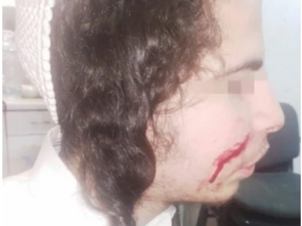 В Умани напали на подростков хасидов: у одного парня ножевое раненение (ФОТО, ВИДЕО)