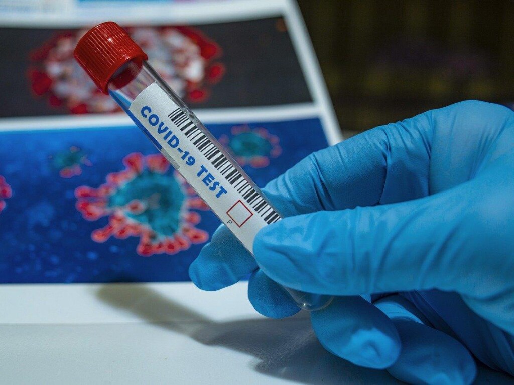 В Украине более 300 тысяч человек заразились коронавирусом