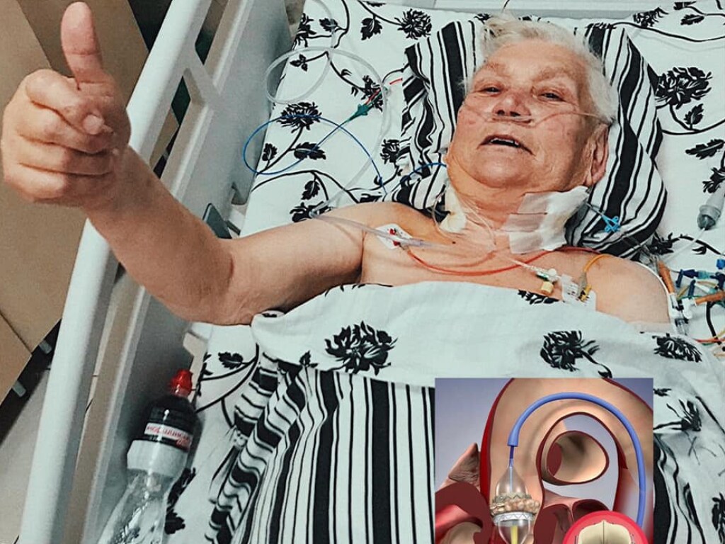 Львовские хирурги провели уникальную операцию на сердце: без единого разреза (ФОТО)