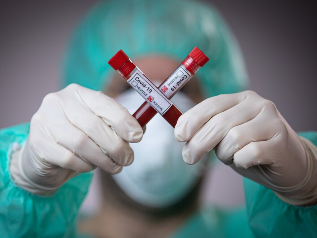 В Украине напряженная ситуация с тестированием на коронавирус – врач  