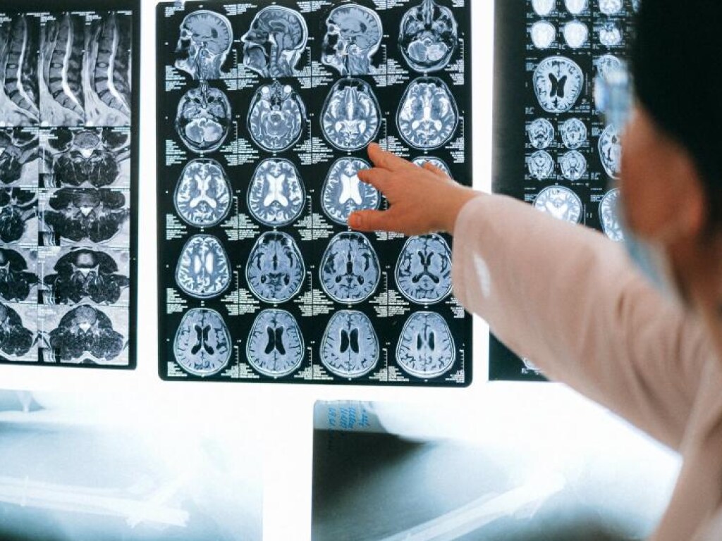 Эксперты выяснили удивительный факт о человеческом мозге