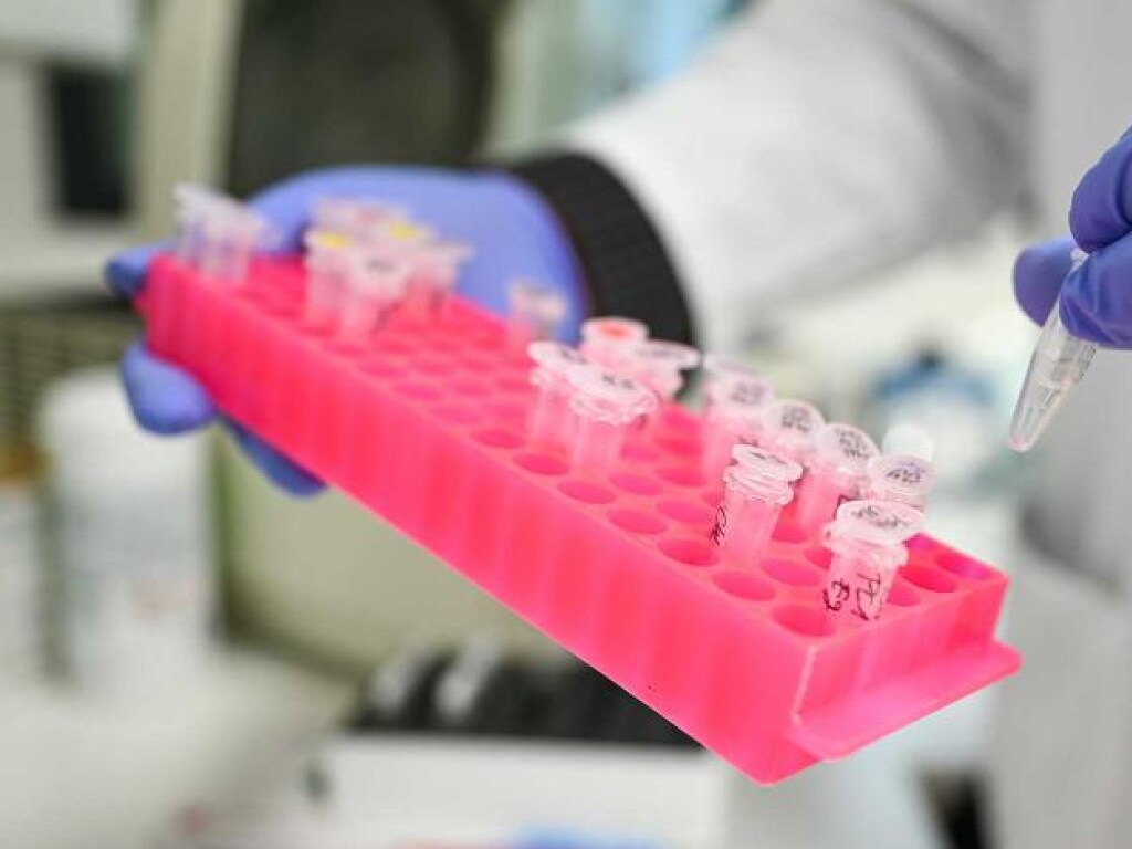 В Житомирской области за сутки 398 новых случаев COVID-19