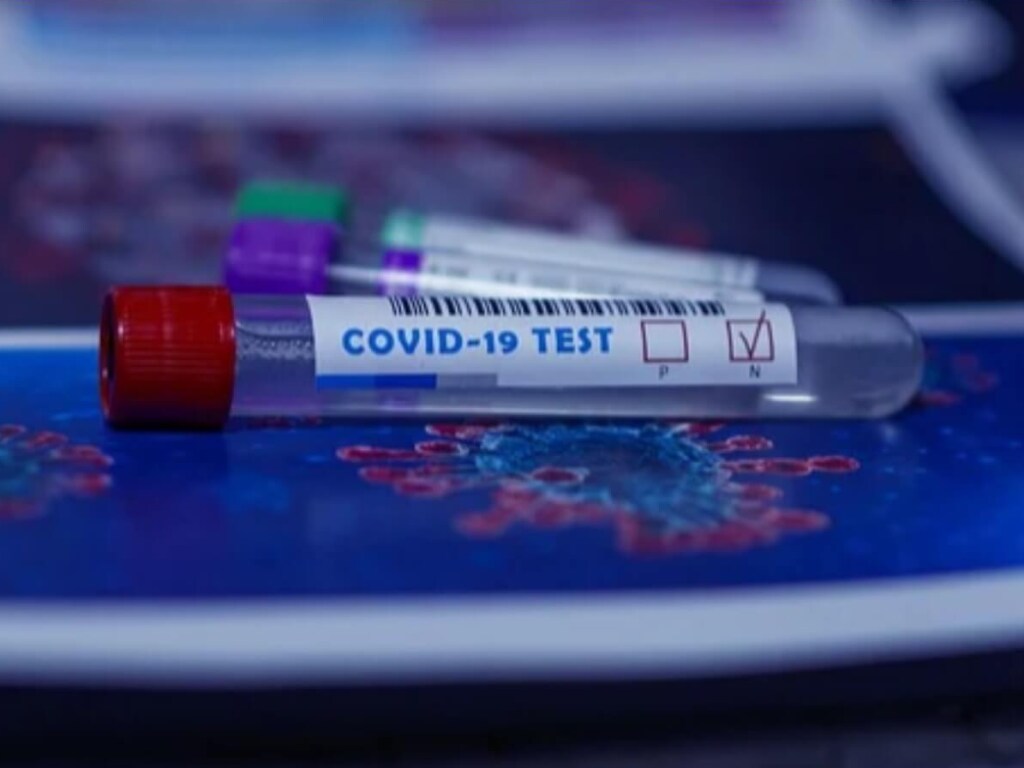Врач-инфекционист: пока неясно, как долго антитела в крови защищают от коронавируса