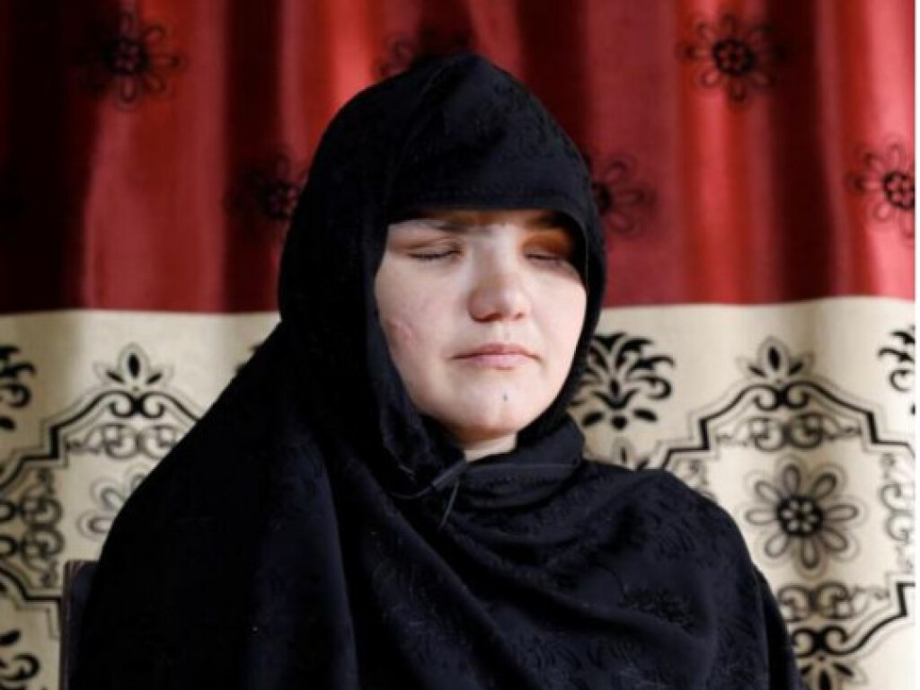 В Афганистане талибы лишили девушку глаз за «дерзкое» поведение (ФОТО)