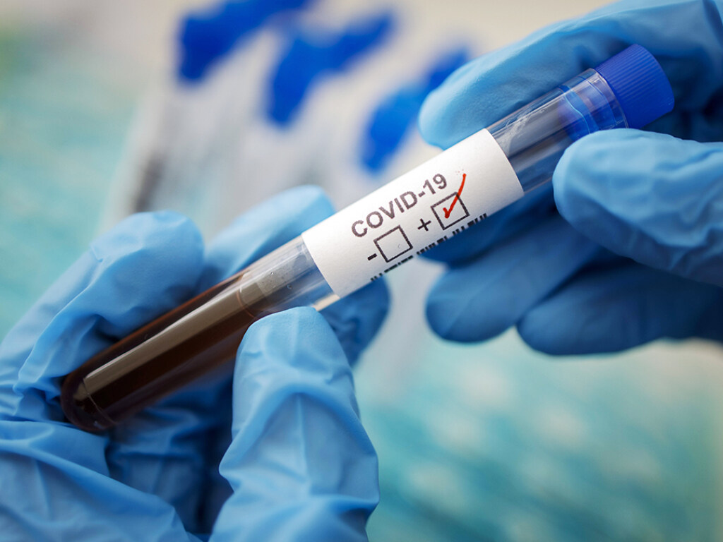 Ускорить выдачу результатов по коронавирусным тестам можно с помощью частных лабораторий &#8212; врач